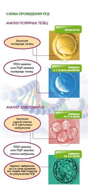 Преимплантационная генетическая диагностика (ПГД) в Омске Преимплантационная генетическая диагностика