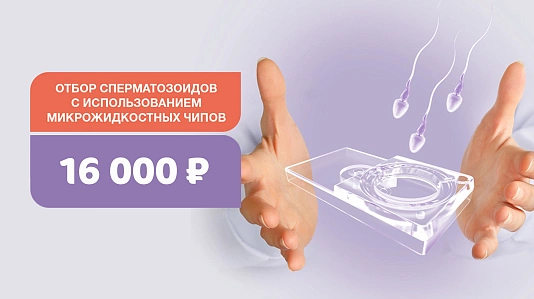 Отбор сперматозоидов с использованием микрожидкостных чипов Fertile®. Повысим шансы на успешное ЭКО. Скидка 30%